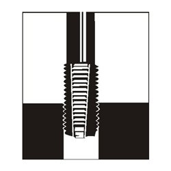 V-COIL Gewindeeinsatz für Zündkerzengewinde M14x1,25-8,4mm